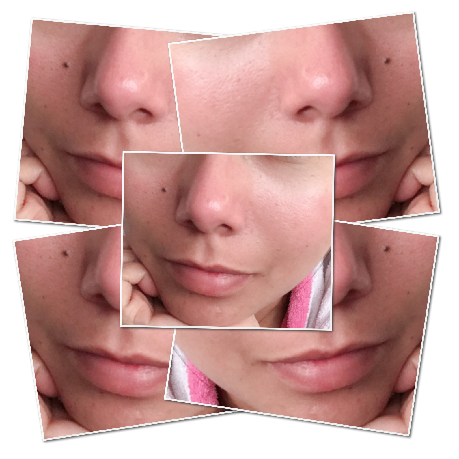 Facial care